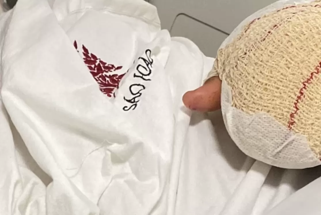 Governo português investiga caso de menino brasileiro que teve dedos decepados em escola