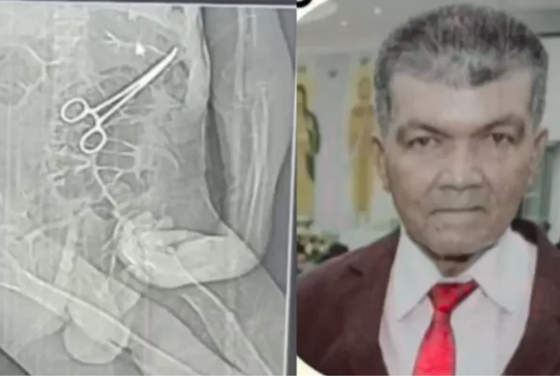 Idoso morre após pinça supostamente ser esquecida dentro dele após cirurgia